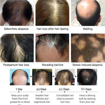 Verra™ Hair Growth Serum Roll-On | 25ml